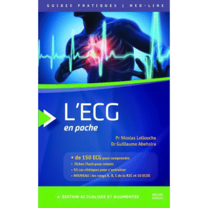 L'ECG en poche